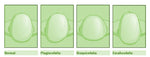 Cuscino + Federa Neonato Carrozzina in memory foam